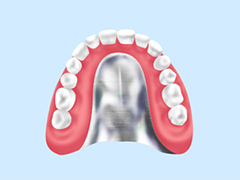 金属床義歯（自費）
