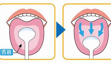 腸内細菌を健康にするには舌清掃を!?　（舌清掃について）