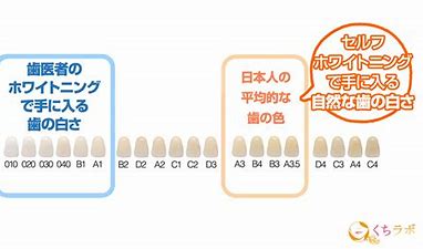 歯医者さんのホワイトニングとセルフホワイトニングの違いは？　明らかに違います！