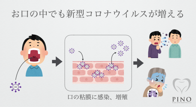 お口のメンテナンスすることもコロナ感染予防！　～コロナで過ぎた1年～