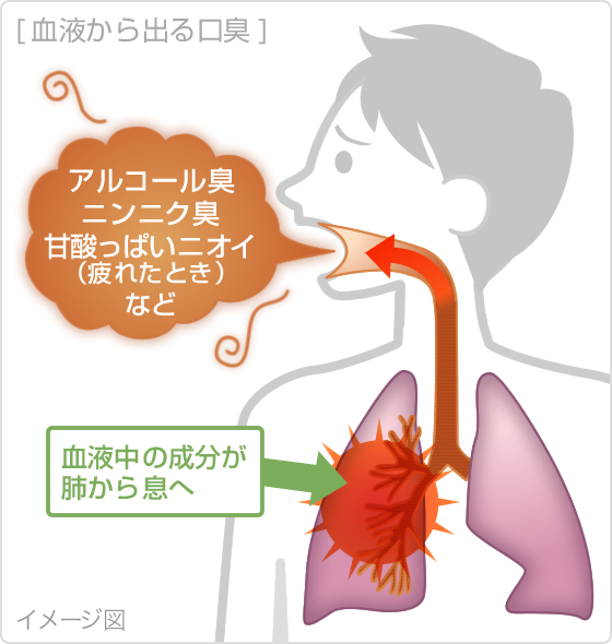 ダイエットで口臭？　ダイエットすると口臭がきつくなる⁈