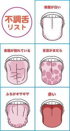 舌は健康のバロメーター！　～全身の不調は舌に出る！～