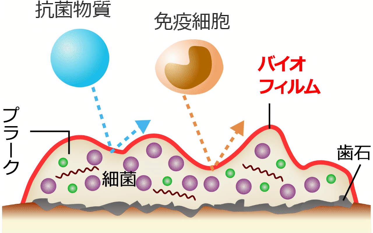 お口の細菌は体の中で最も高密度！！　　～バイオフィルムって～