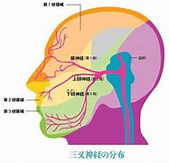 虫歯やお口に原因ないけど歯が痛い!!　～三叉神経痛かも～