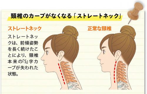 スマホが原因で“顎が痛い！　～「スマホ顎関節症」が増加～