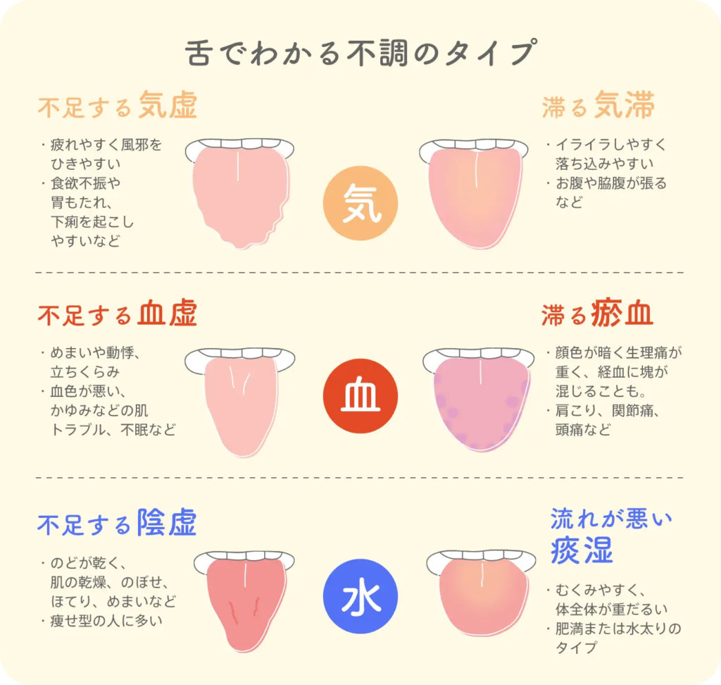 舌は身体の健康を表す!?　　～東洋医学での舌診～