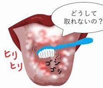  舌を磨いても舌が白いのは病気なの？